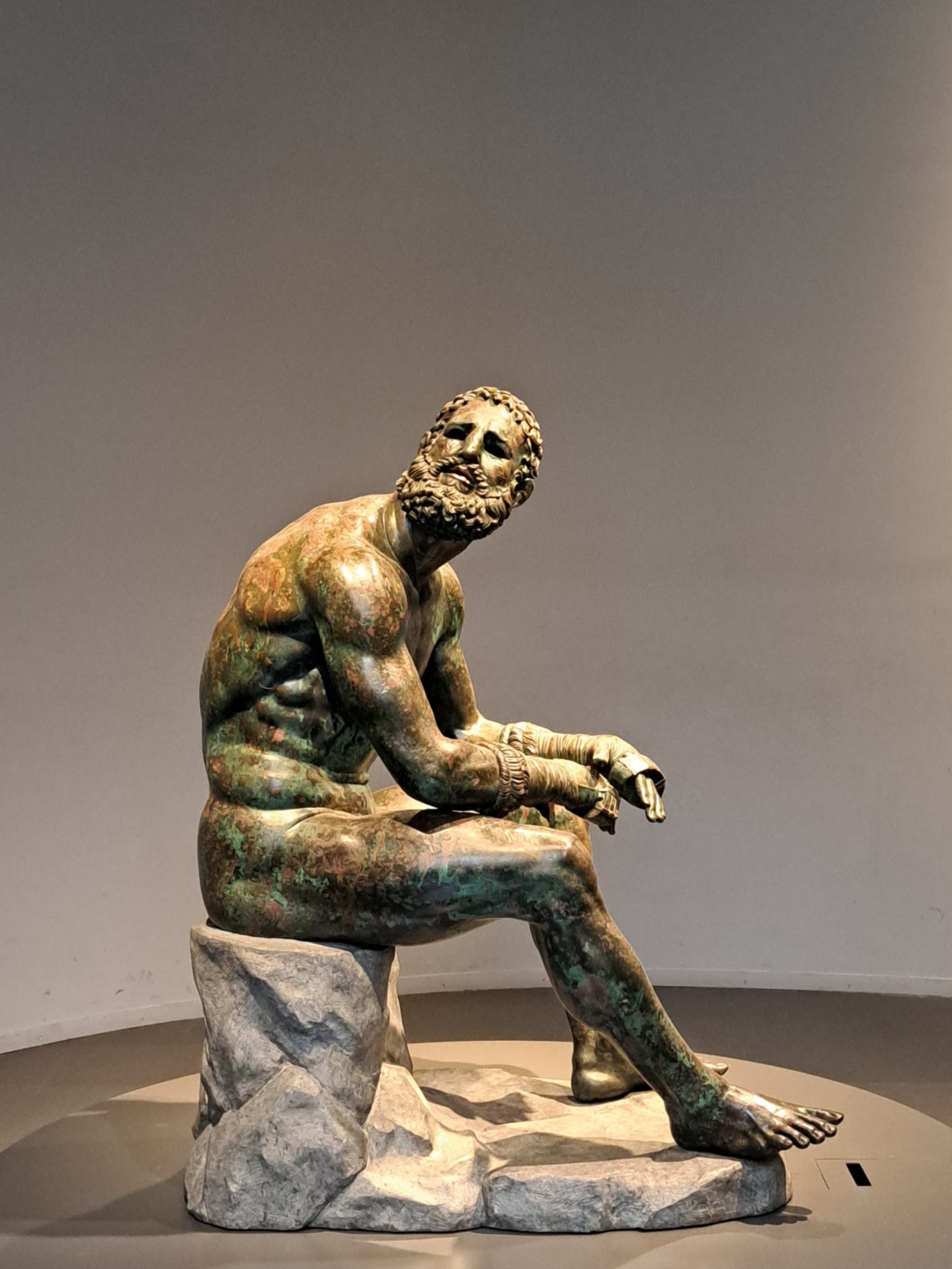 bronze hellénistique représentant un boxeur au repos après le combat. Cette œuvre illustre la noblesse et la souffrance du sportif, et suggère la transformation intérieure née de l’effort.